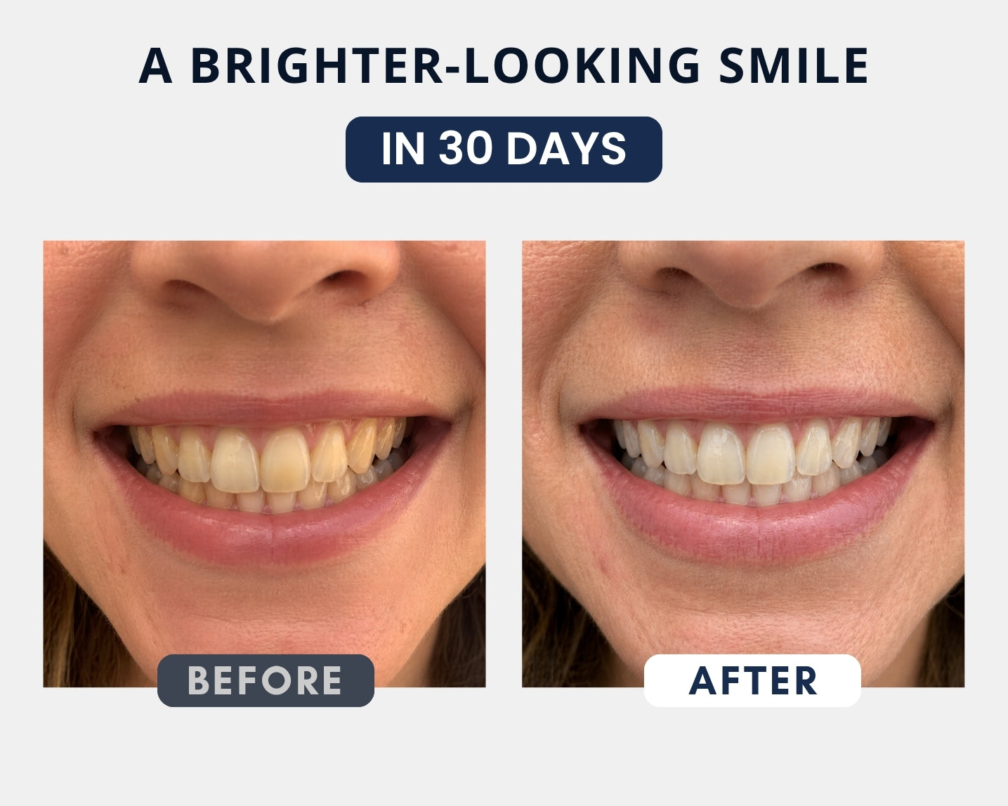 Whitening Powder with Nano-Hydroxyapatite + PAP
