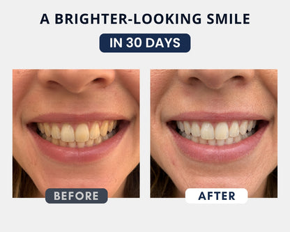 Whitening Powder with Nano-Hydroxyapatite + PAP